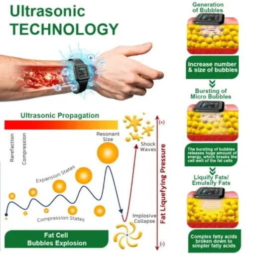 Winter Sale Futusly™ Ultrasonic Fat Removal and Detox Bracelet - Image 12