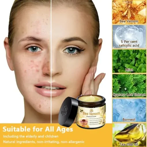 Winter Sale TGA Endorsed | Turonu™ Bee Venom Skin Treatment Cream - Image 12