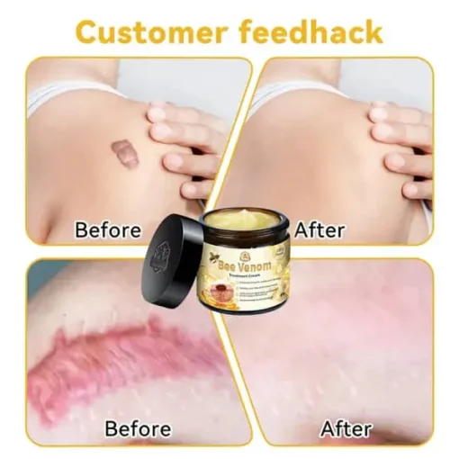 Winter Sale TGA Endorsed | Turonu™ Bee Venom Skin Treatment Cream - Image 9