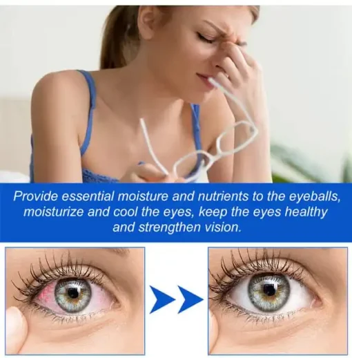 Winter Sale THONESR™ Vision recovery eye drops - Image 10