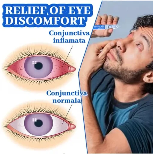 THONESR™ Vision recovery eye drops - Image 5