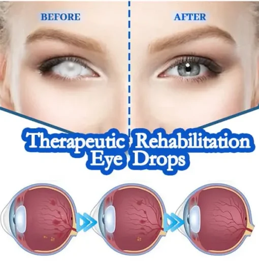 THONESR™ Vision recovery eye drops - Image 6