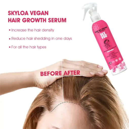 Winter Sale DeeVoo™ Luxe Bee venom Scalp Treatment HairGrᴏᴡth Hair Spray - Image 11