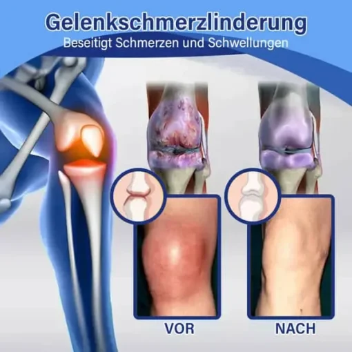 flysmus™ Lidocain Sofortige Schmerzlinderung Heilende Flüssigkeit - Image 11