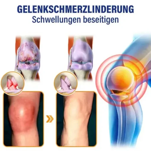 flysmus™ Lidocain Sofortige Schmerzlinderung Heilende Flüssigkeit - Image 12