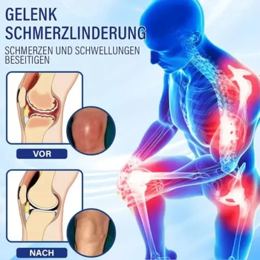 flysmus™ Lidocain Sofortige Schmerzlinderung Heilende Flüssigkeit - Image 8