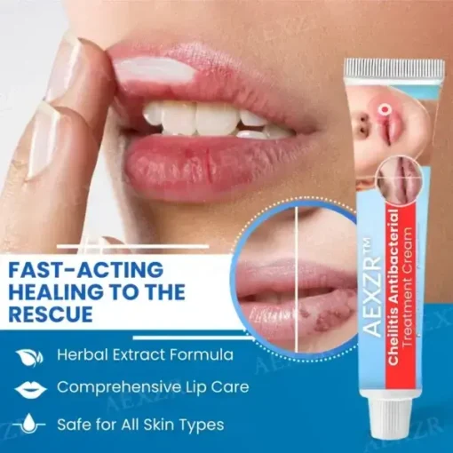 AEXZR™ Cheilitis Antibacterial Treatment Cream - Image 6