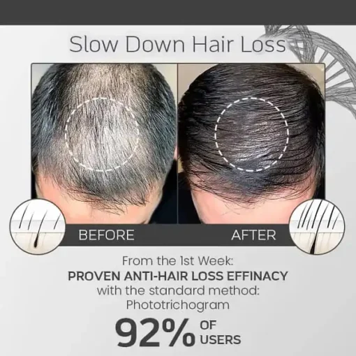 Ceoerty™ Hair Loss Defense Spray - Image 5