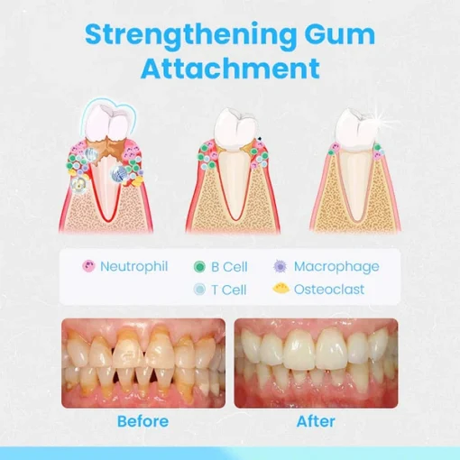 Ceoerty™ RevitaDent Gum Repair Strips - Image 6