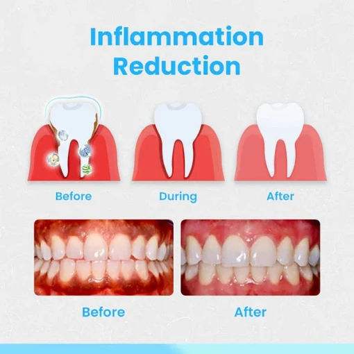 Ceoerty™ RevitaDent Gum Repair Strips - Image 7