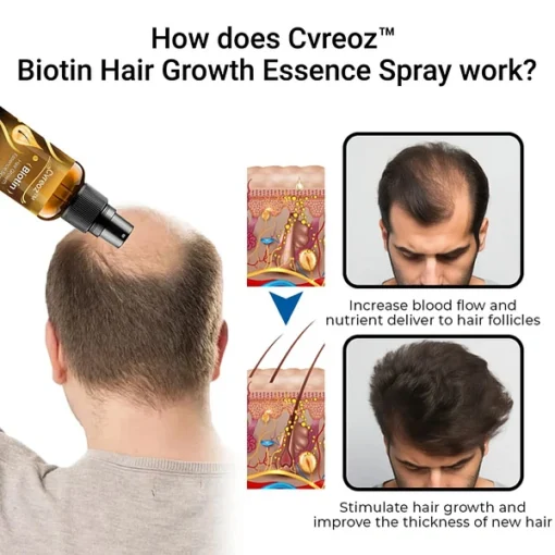 Cvreoz™ Biotin Hair Growth Essence Spray - Image 7