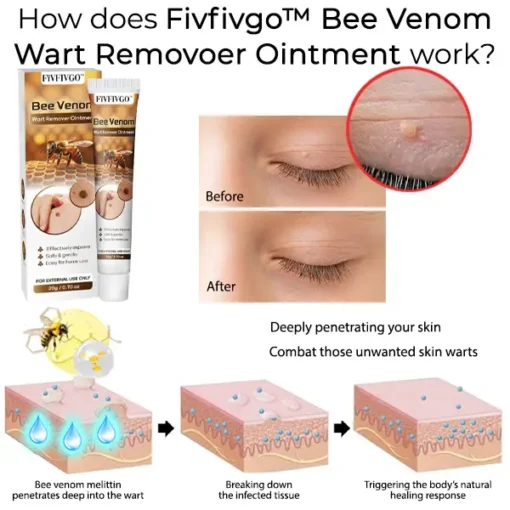 Fivfivgo™ Bee Venom Wart Remover Ointment - Image 2