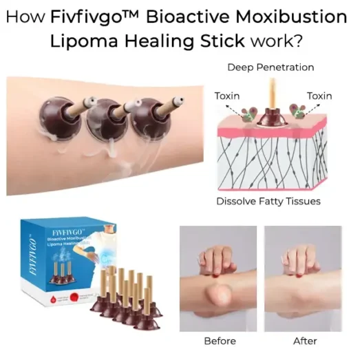 Fivfivgo™ Bioactive Moxibustion Lipoma Healing Stick - Image 2