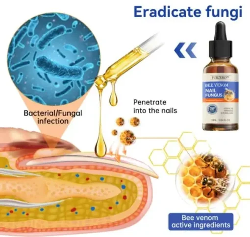 Winter Sale Furzero™ Bee Venom Nail Fungus Treatment Solution: Restore nail health - Image 7