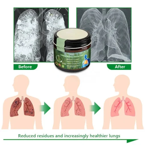 Lercea Mullein Clear Lung Repair Cream – American Thoracic Society Endorsed to Support Lung Health - Image 9