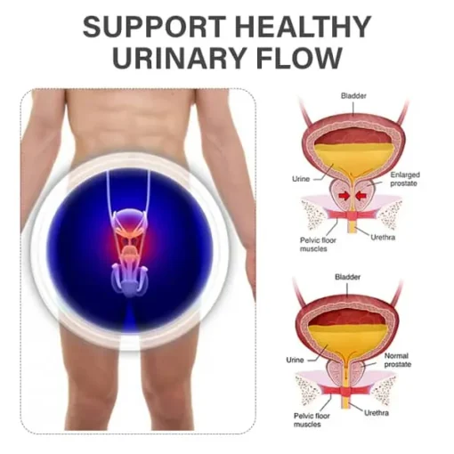 DISYAN™ Prostate Magnetic Therapy Bracelet - Image 2
