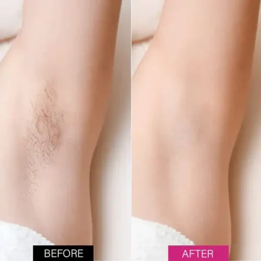 Winter Sale Fivfivgo™ BeeSilk Hair Removal Mousse - Image 9