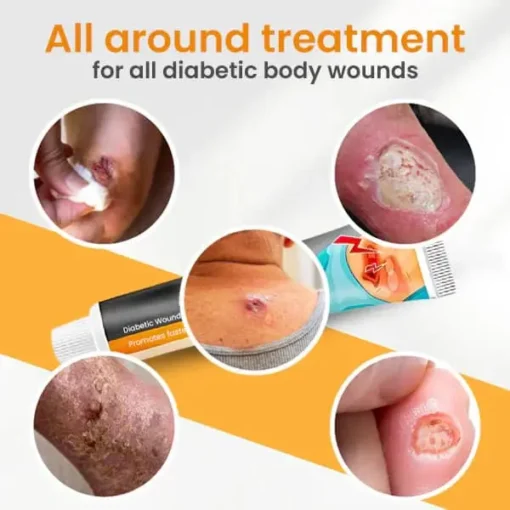 Winter Sale Fivfivgo™ Diabetic Wounds Treatment Cream - Image 3