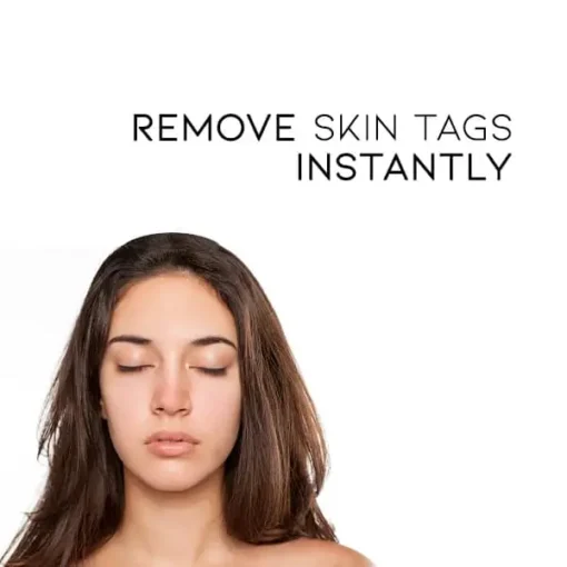 Winter Sale Fivfivgo™ WipeOff Tags & Mole Remover - Image 3