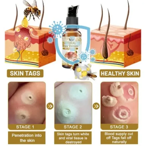 Winter Sale Furzero™ Natural Bee Venom Skin Repair Serum - Image 2