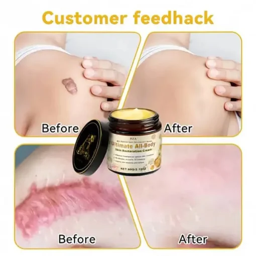 HZA™ Bee Poison Skin Treatment Cream - Image 7