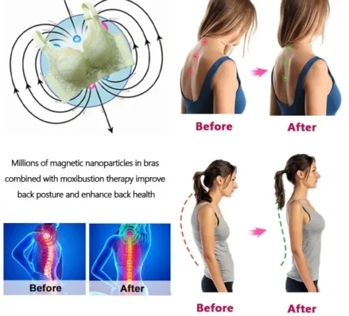 Winter Sale Neslemy™ Ion Lift Correction Lymph Drainage Bra - Image 8