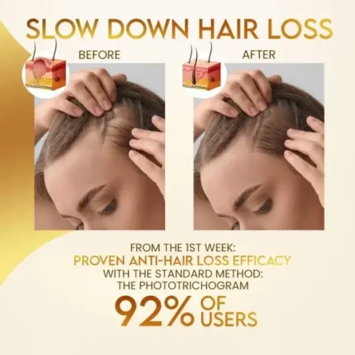 Stovis™ Biotin Boost Hair Growth Spray - Image 2