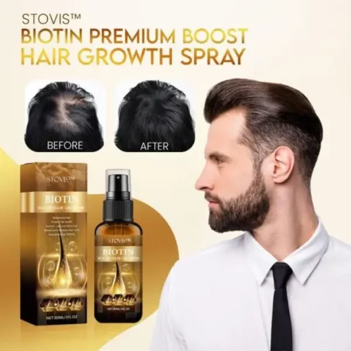 Winter Sale Stovis™ Biotin Boost Hair Growth Spray - Image 3