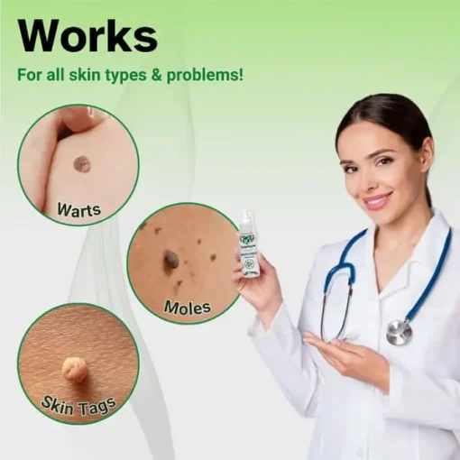 Winter Sale YUNPSO Herbal Moles & Warts Removal Spray - Image 6